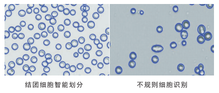 細(xì)胞計(jì)數(shù)儀細(xì)胞劃分圖片